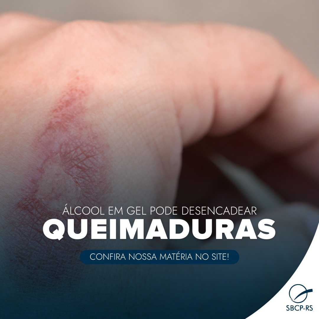 Álcool em gel pode desencadear queimaduras, entenda